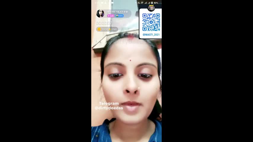 MYD-SPG-CHAMET-1222024- 756